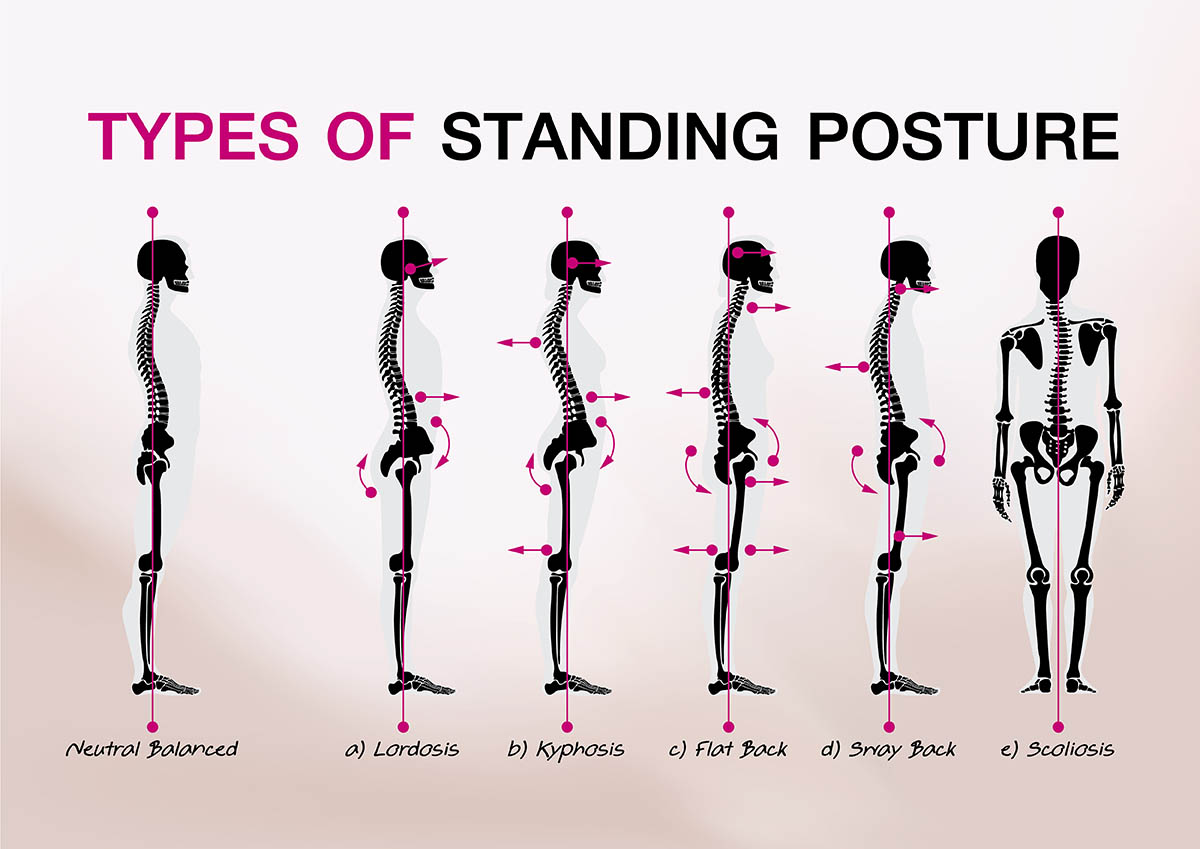 Was ist Postural Assessment?