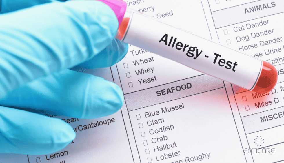 5 selected allergy test offers in Göttingen – Identifying possible triggers of allergic symptoms